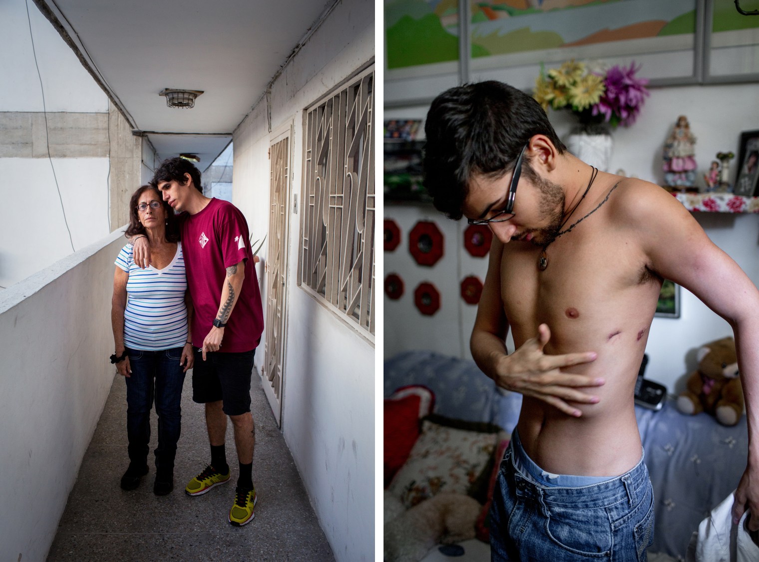 MOTHER/SON: August 1, 2017. Caracas. (El Valle). Juan Carlos Ramos (Koji), 34, poses for a portrait with his mother, Raquel Velasquez, 66, in their building in El Valle. The barrio of El Valle, once a stronghold of Chavismo, has been the site of violent confrontations between protesters, police, and pro-government gangs in recent months, resulting in several deaths within blocks of his home. A DJ and clothing designer, he say the parties he used to play at have stopped, and because of the inflation and disruptions from the protests he hasn't been able to fill orders for his clothing brand. I ask if he thinks about leaving the country? "Every day," he responds, but he doesn't want to leave his family. Velasquez was once a leftist activist, but now she is an organizer for Primer Justicia, an opposition party. When asked what issues are most important to her she responds immediately, "The future. A future for my children. A country where my whole family doesn't have to immigrate and we can be together. Our table used to be full at holidays. Now we're spread out all over the world.â BODY: August 2, 2017. Caracas. Pedro Yammine, 22, shows puncture wounds in his side at his neighbors apartment, from where he had to have tubes in his lungs after being run over by a tank during the protests in May. He had 13 fractures all together, his lungs were punctured and filled with fluid, he had massive contusions. But he lived and today is recuperating well under the watchful eye of his terrified mother.